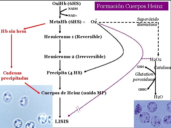 Oxi. Hb (6 HS) NADH NAD+ Formación Cuerpos Heinz - Meta. Hb (6 HS)