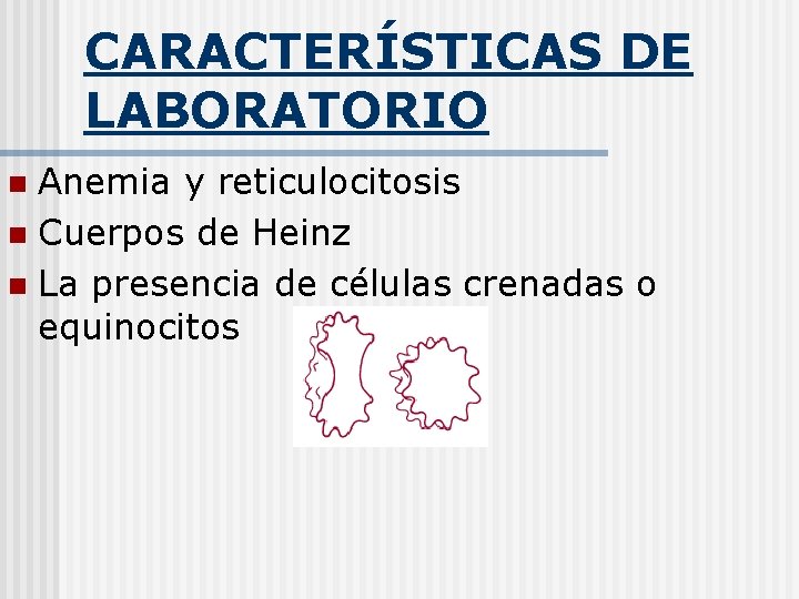 CARACTERÍSTICAS DE LABORATORIO Anemia y reticulocitosis n Cuerpos de Heinz n La presencia de