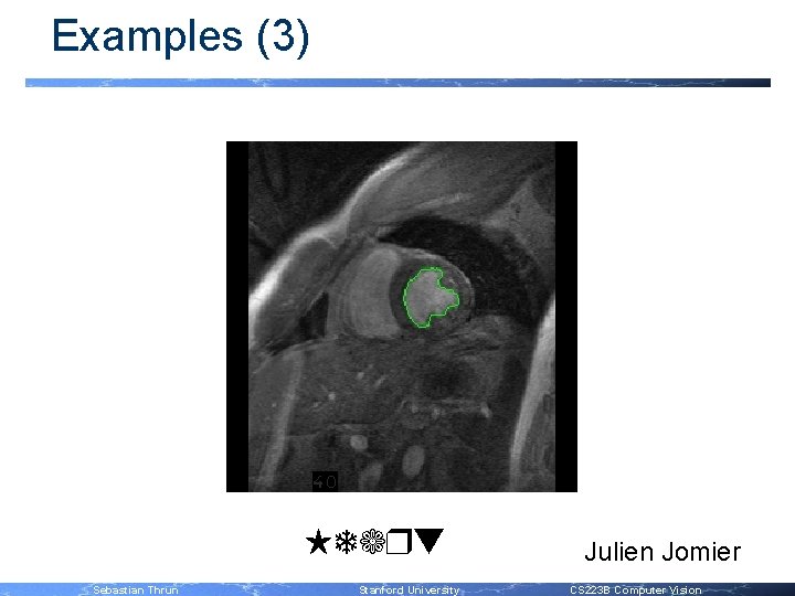 Examples (3) Heart Sebastian Thrun Stanford University Julien Jomier CS 223 B Computer Vision