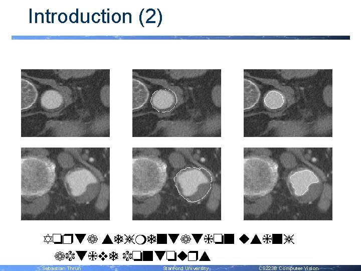 Introduction (2) Aorta segmentation using active contours Sebastian Thrun Stanford University CS 223 B