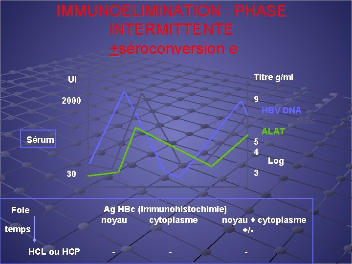 IMMUNOELIMINATION : PHASE INTERMITTENTE +séroconversion e UI 2000 Sérum 30 Titre g/ml 9 HBV