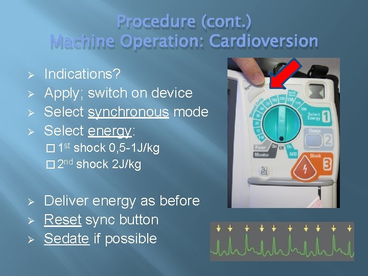 Procedure (cont. ) Machine Operation: Cardioversion Ø Ø Indications? Apply; switch on device Select