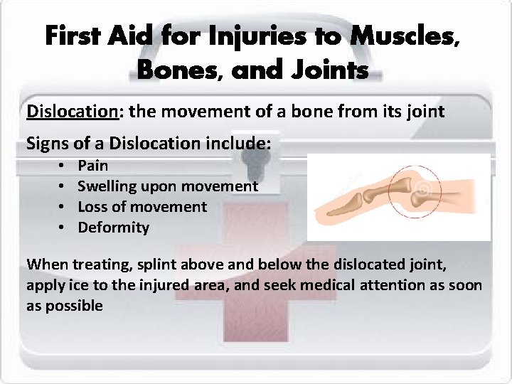 First Aid for Injuries to Muscles, Bones, and Joints Dislocation: the movement of a