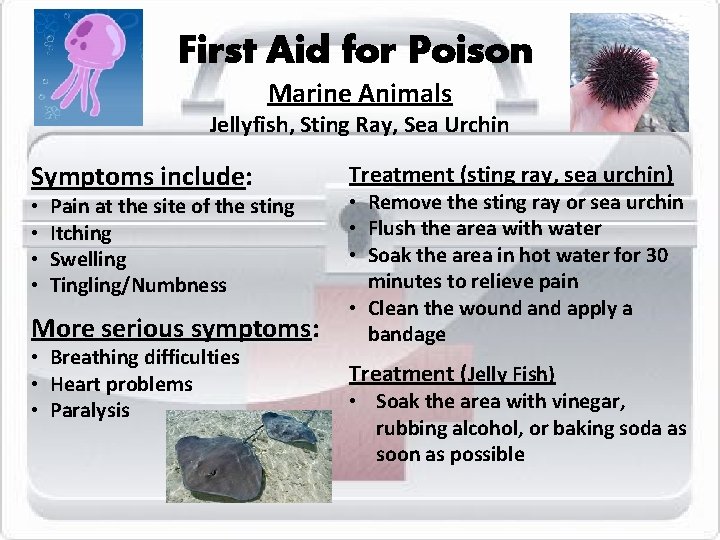 First Aid for Poison Marine Animals Jellyfish, Sting Ray, Sea Urchin Symptoms include: •