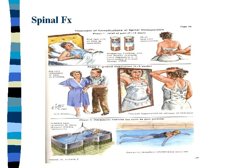 Spinal Fx 