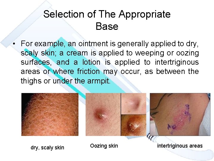 Selection of The Appropriate Base • For example, an ointment is generally applied to