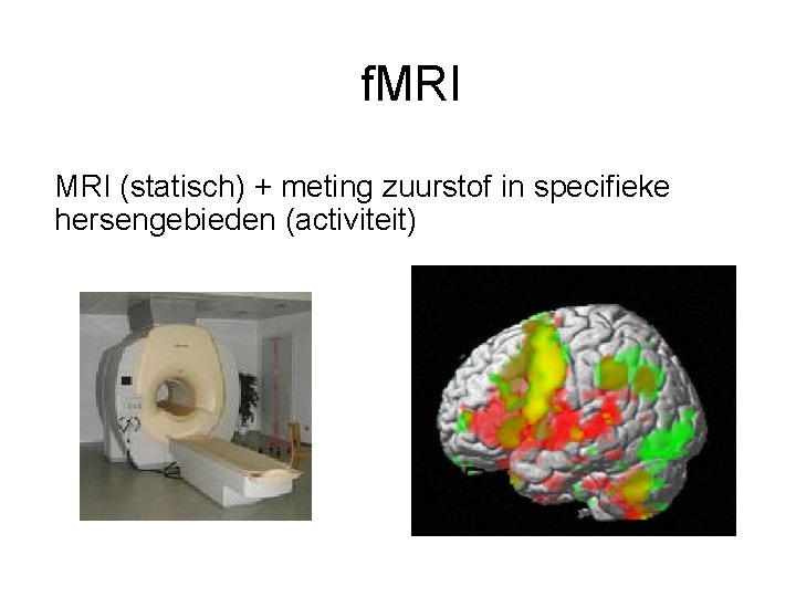 f. MRI (statisch) + meting zuurstof in specifieke hersengebieden (activiteit) 