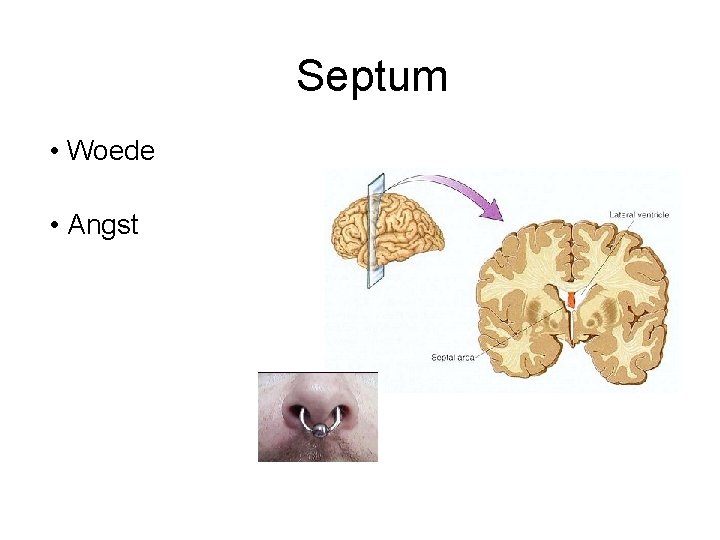 Septum • Woede • Angst 