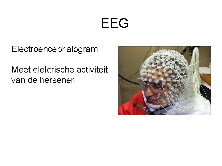 EEG Electroencephalogram Meet elektrische activiteit van de hersenen 