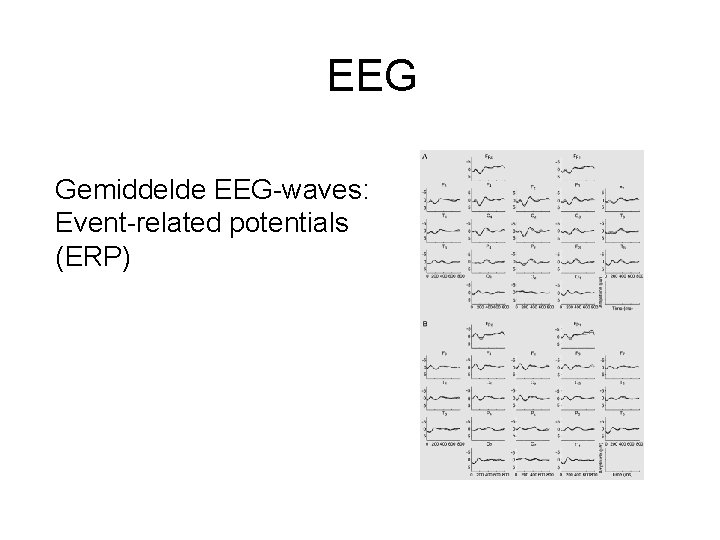 EEG Gemiddelde EEG-waves: Event-related potentials (ERP) 