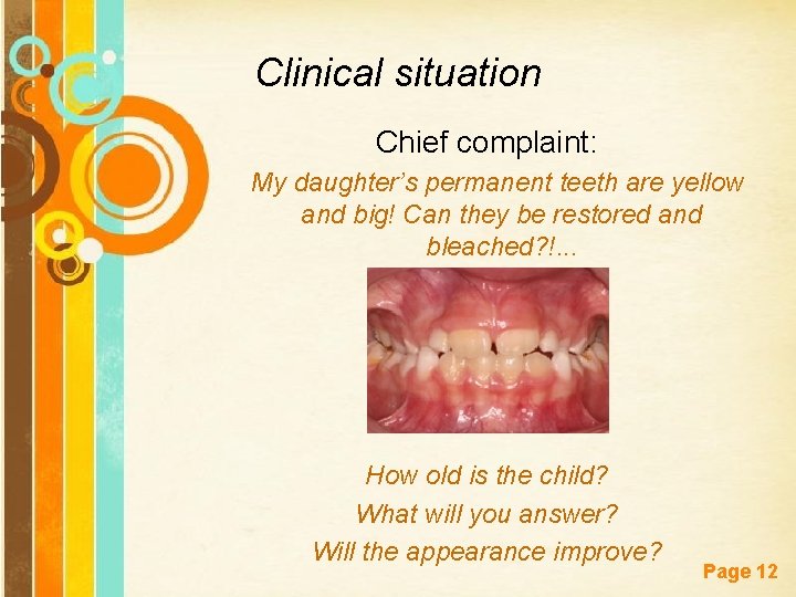 Clinical situation Chief complaint: My daughter’s permanent teeth are yellow and big! Can they