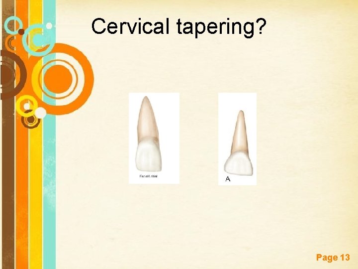 Cervical tapering? Free Powerpoint Templates Page 13 