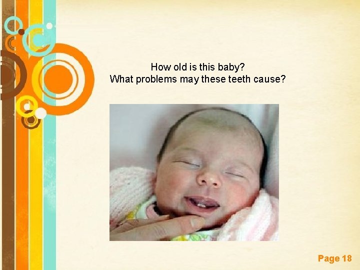 How old is this baby? What problems may these teeth cause? Free Powerpoint Templates