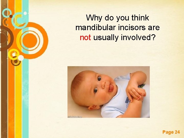 Why do you think mandibular incisors are not usually involved? Free Powerpoint Templates Page
