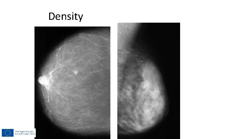 Density Density
