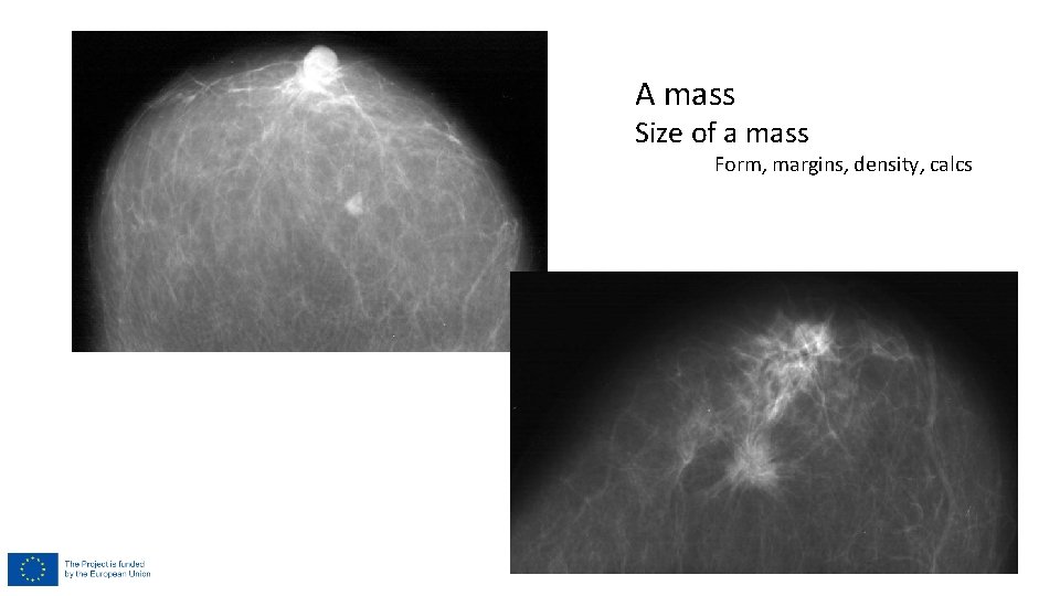 A mass Size of a mass Form, margins, density, calcs A mass Size of a mass Form, margins, density, calcs