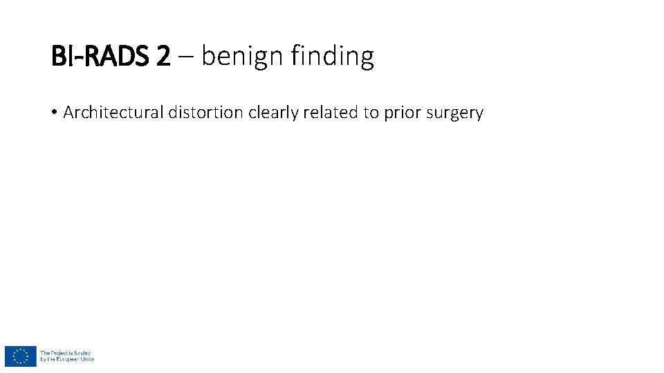BI-RADS 2 – benign finding • Architectural distortion clearly related to prior surgery BI-RADS 2 – benign finding • Architectural distortion clearly related to prior surgery