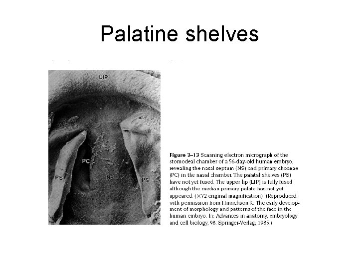 Palatine shelves 