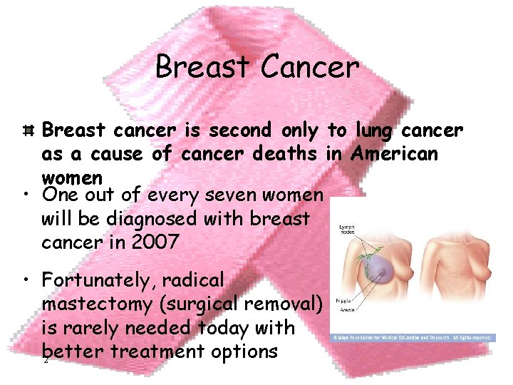 Breast Cancer Breast cancer is second only to lung cancer as a cause of