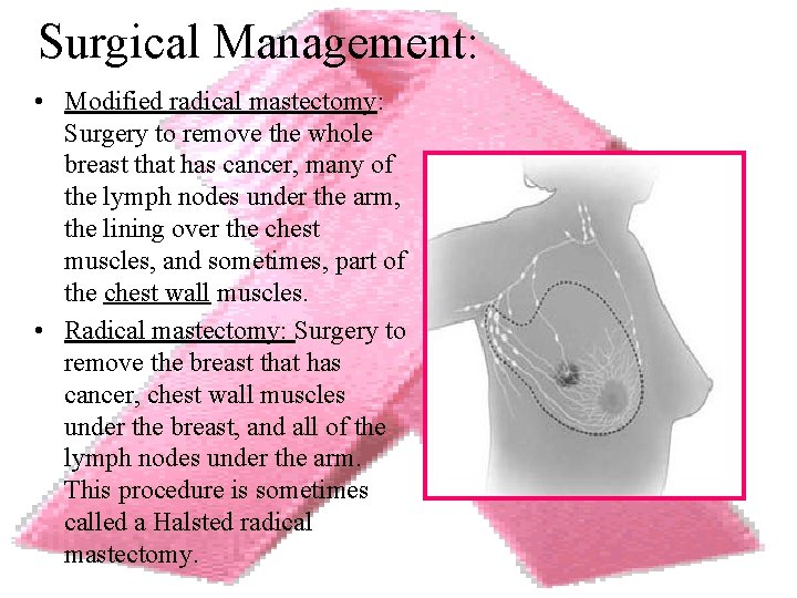 Surgical Management: • Modified radical mastectomy: Surgery to remove the whole breast that has
