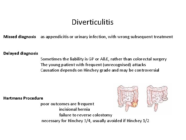 Diverticulitis Missed diagnosis as appendicitis or urinary infection, with wrong subsequent treatment Delayed diagnosis Diverticulitis Missed diagnosis as appendicitis or urinary infection, with wrong subsequent treatment Delayed diagnosis