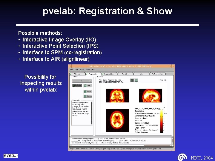 pvelab: Registration & Show Possible methods: • Interactive Image Overlay (IIO) • Interactive Point