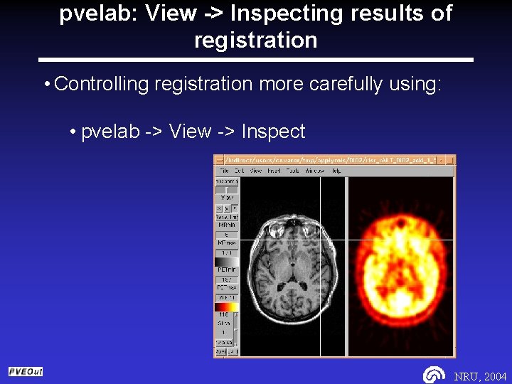 pvelab: View -> Inspecting results of registration • Controlling registration more carefully using: •