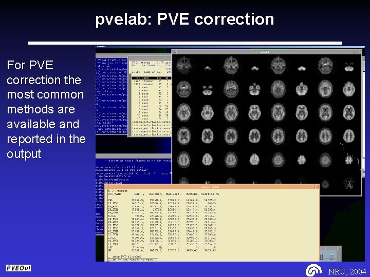 pvelab: PVE correction For PVE correction the most common methods are available and reported