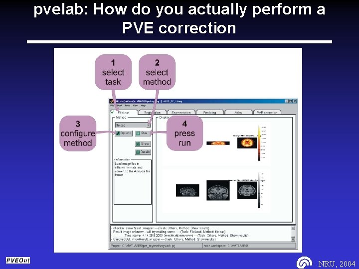 pvelab: How do you actually perform a PVE correction NRU, 2004 