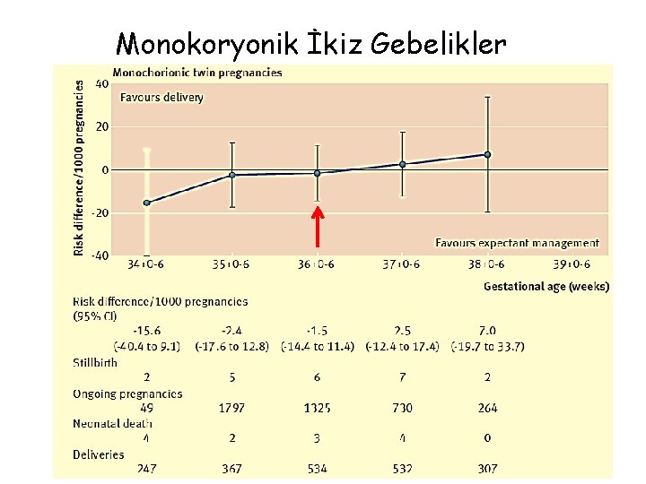 Monokoryonik İkiz Gebelikler 