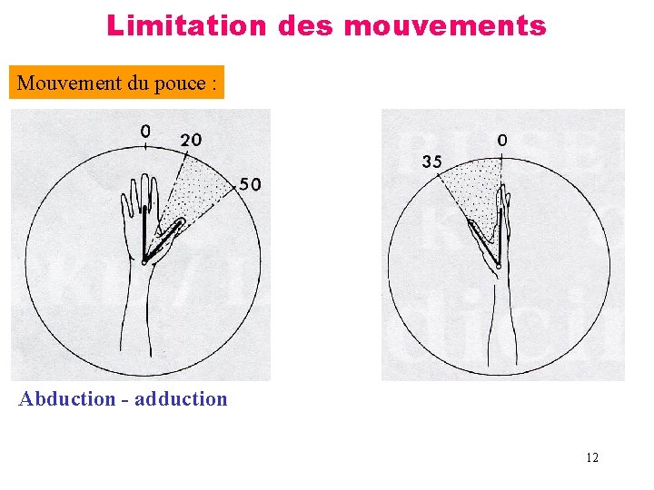 Limitation des mouvements Mouvement du pouce : Abduction - adduction 12 