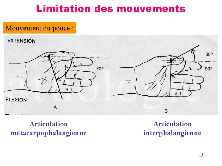 Limitation des mouvements Mouvement du pouce : Articulation métacarpophalangienne Articulation interphalangienne 13 