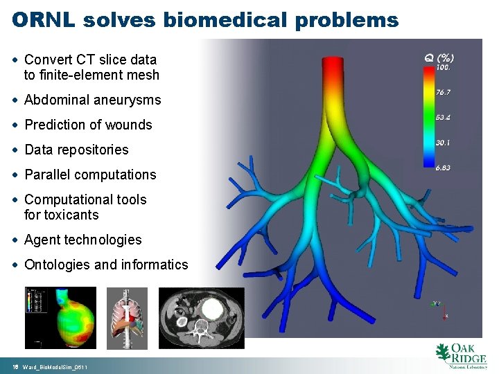 ORNL solves biomedical problems · Convert CT slice data to finite-element mesh · Abdominal