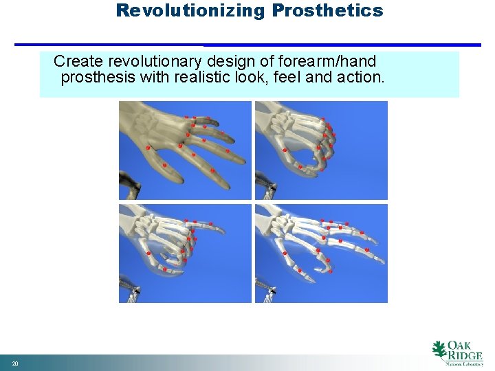 Revolutionizing Prosthetics Create revolutionary design of forearm/hand prosthesis with realistic look, feel and action.