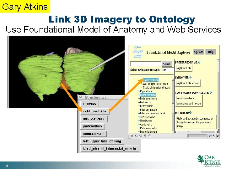 Gary Atkins Link 3 D Imagery to Ontology Use Foundational Model of Anatomy and