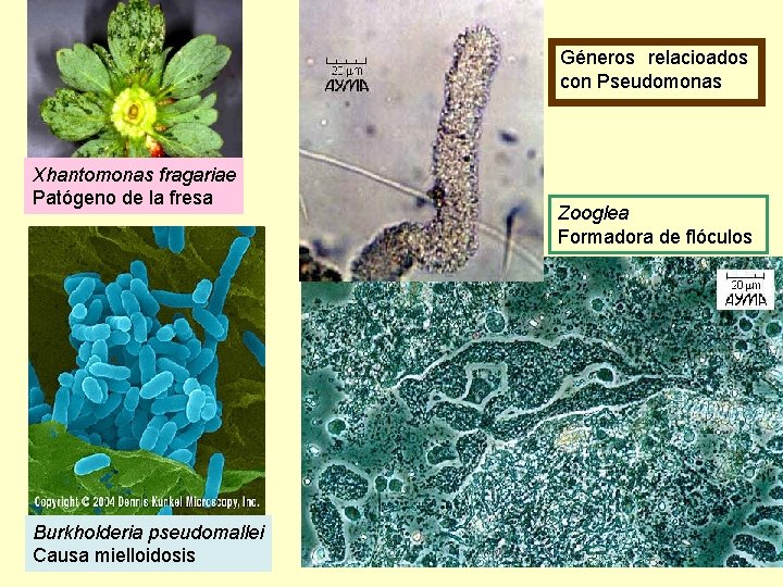 Géneros relacioados con Pseudomonas Xhantomonas fragariae Patógeno de la fresa Burkholderia pseudomallei Causa mielloidosis