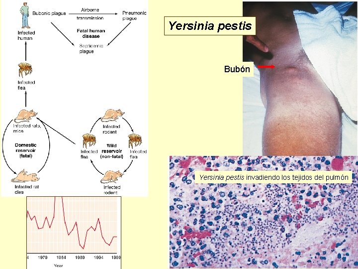 Yersinia pestis Bubón Yersinia pestis invadiendo los tejidos del pulmón 