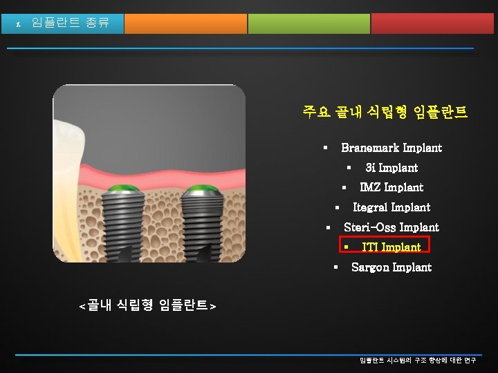 1. 임플란트 종류 주요 골내 식립형 임플란트 § Branemark Implant § § 3 i