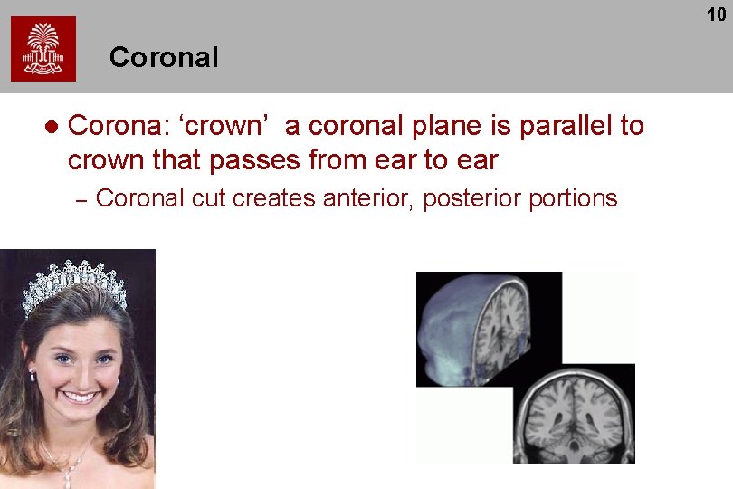 10 Coronal l Corona: ‘crown’ a coronal plane is parallel to crown that passes