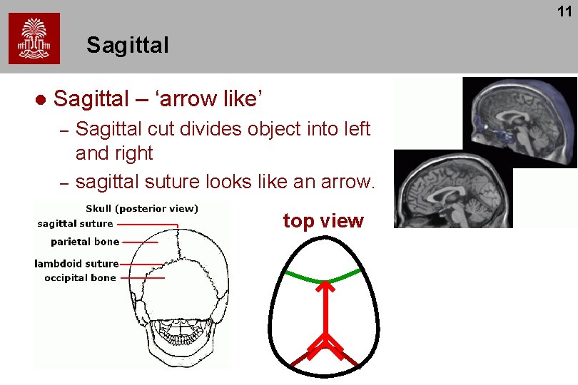 11 Sagittal l Sagittal – ‘arrow like’ – – Sagittal cut divides object into