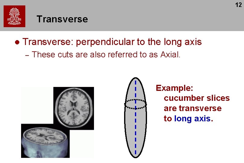 12 Transverse l Transverse: perpendicular to the long axis – These cuts are also