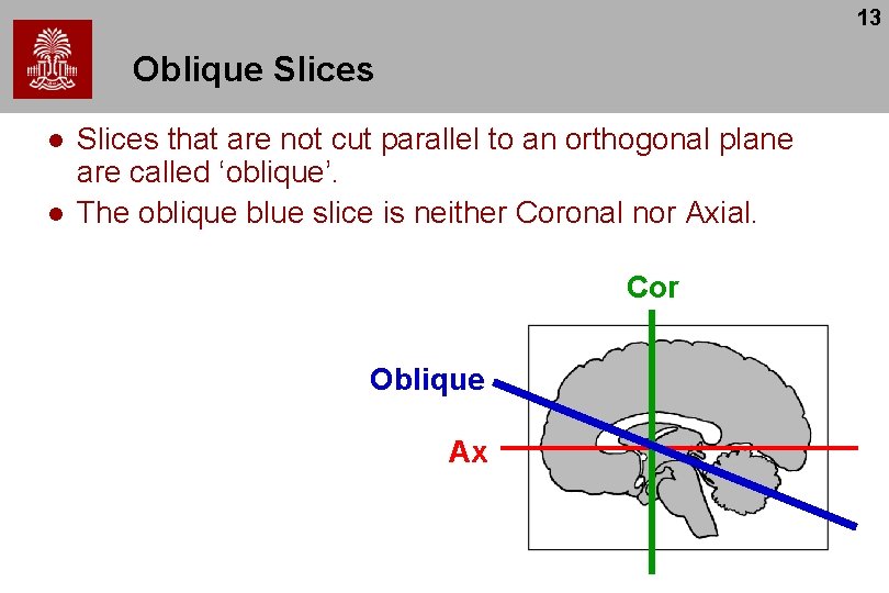 13 Oblique Slices l l Slices that are not cut parallel to an orthogonal