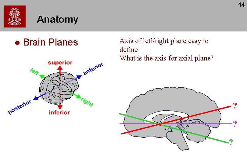 14 Anatomy l Brain Planes Axis of left/right plane easy to define What is