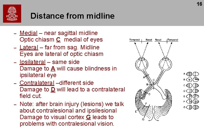 16 Distance from midline – – – Medial – near sagittal midline Optic chiasm