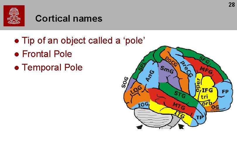 28 Cortical names Tip of an object called a ‘pole’ l Frontal Pole l