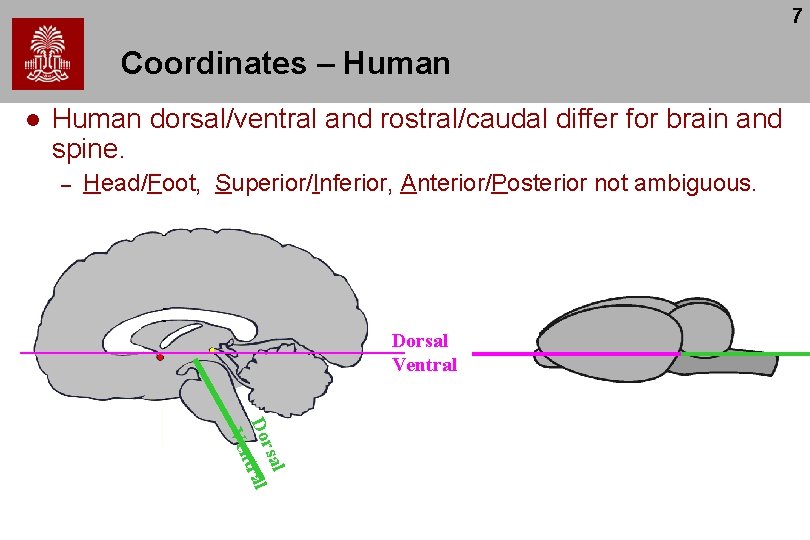 7 Coordinates – Human l Human dorsal/ventral and rostral/caudal differ for brain and spine.