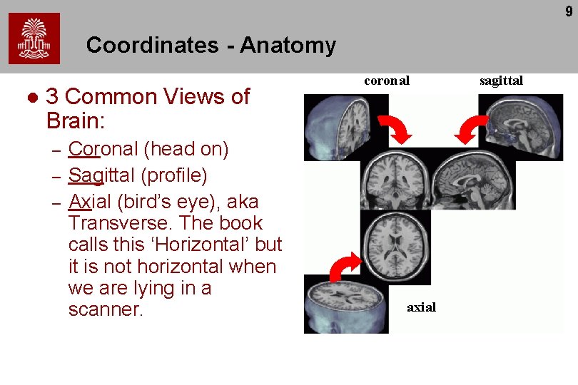9 Coordinates - Anatomy l 3 Common Views of Brain: – – – Coronal