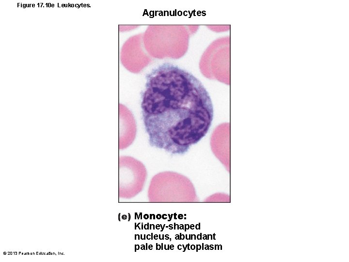 Figure 17. 10 e Leukocytes. © 2013 Pearson Education, Inc. Agranulocytes Monocyte: Kidney-shaped nucleus,