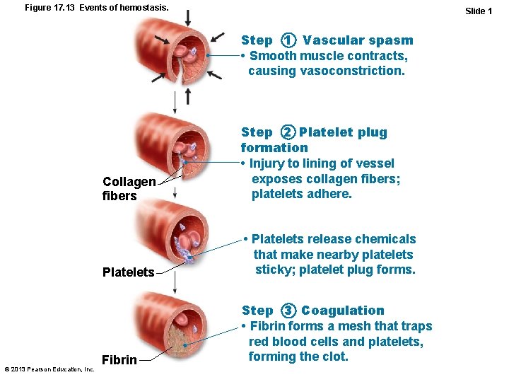 Figure 17. 13 Events of hemostasis. Slide 1 Step 1 Vascular spasm • Smooth