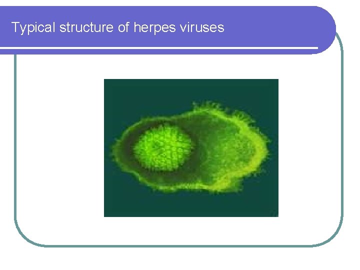 Typical structure of herpes viruses 